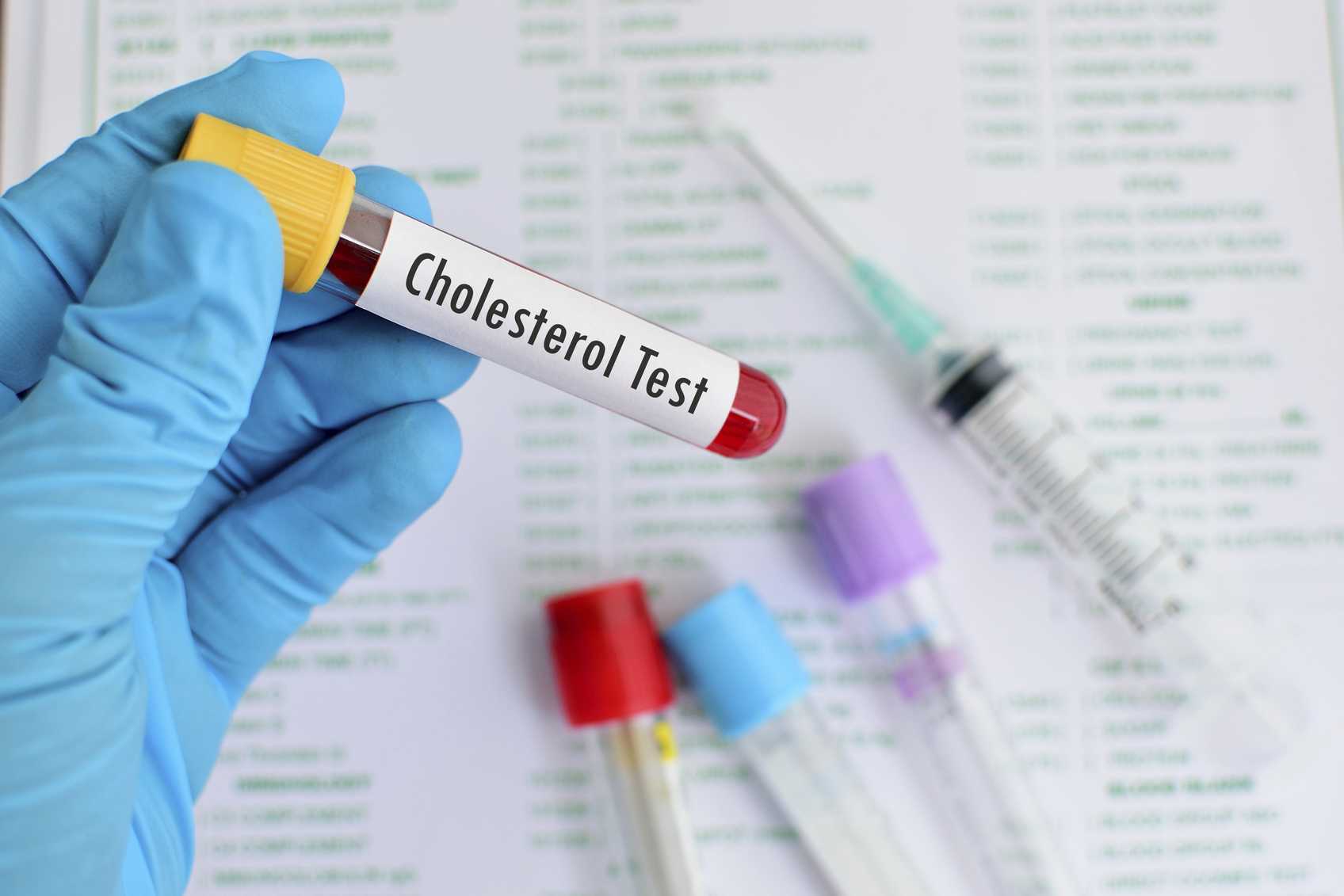 Should Diabetics Take Cholesterol Medication? | Georgia Medicare Plans